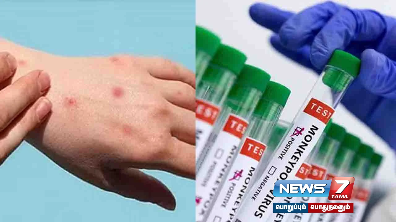 #MonkeyPox | #MVABNVacccine | #WHO |