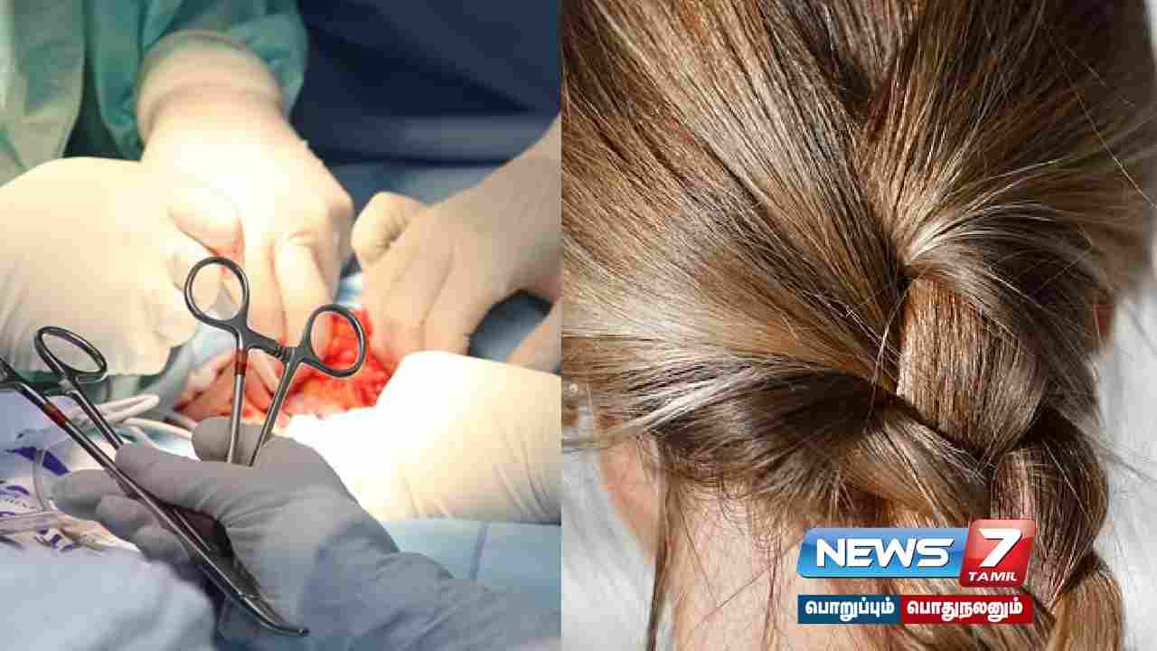 uttar pradesh, girl, hair, eat, disease