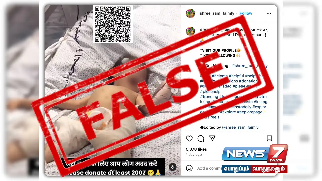 Fraud in India on child injured in Gaza war - What did fact check find?